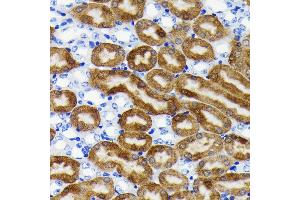 Immunohistochemistry of paraffin-embedded mouse kidney using NQO1 antibody (ABIN7268795) at dilution of 1:100 (40x lens).