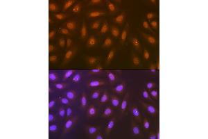 Immunofluorescence analysis of U-2 OS cells using Syntenin Rabbit mAb (ABIN7270680) at dilution of 1:100 (40x lens). (SDCBP antibody)