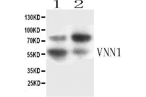 Western blot analysis of VNN1 expression in SKOV3 whole cell lysates ( Lane 3) and HELA whole cell lysates ( Lane 4). (VNN1 antibody  (AA 22-192))