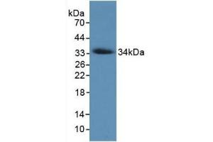 Detection of Recombinant COL7, Human using Monoclonal Antibody to Collagen Type VII (COL7) (COL7A1 antibody  (AA 190-472))