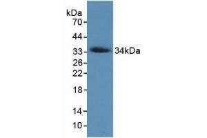 Detection of Recombinant COL7, Human using Monoclonal Antibody to Collagen Type VII (COL7) (COL7 antibody  (AA 190-472))