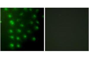 Immunofluorescence analysis of HuvEc cells, using AKAP8 Antibody. (AKAP8 antibody  (AA 331-380))