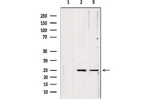Western blot analysis of extracts from various samples, using PLDN antibody. (Pallidin antibody  (C-Term))