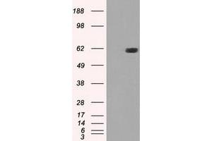 HEK293T cells were transfected with the pCMV6-ENTRY control (Left lane) or pCMV6-ENTRY STK39 (Right lane) cDNA for 48 hrs and lysed. (STK39 antibody)