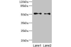 Western blot All lanes: TUBB3 antibody at 6 μg/mL Lane 1: A549 whole cell lysate Lane 2: A431 whole cell lysate Secondary Goat polyclonal to rabbit IgG at 1/10000 dilution Predicted band size: 51, 43 kDa Observed band size: 51 kDa (TUBB3 antibody  (AA 1-210))
