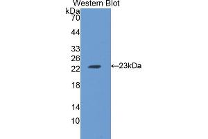 Western blot analysis of the recombinant protein. (FTH1 antibody  (AA 1-182))