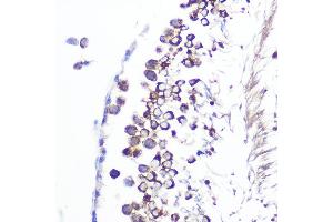 Immunohistochemistry of paraffin-embedded rat testis using J/CSN5/COPS5 Rabbit mAb (ABIN7266497) at dilution of 1:100 (40x lens).