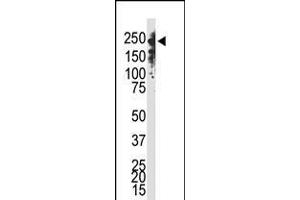Antibody is used in Western blot to detect Dnmt1 in Jurkat cell lysate. (DNMT1 antibody  (C-Term))