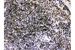 IHC analysis of Bik using anti-Bik antibody (ABIN3043509). (BIK antibody  (AA 1-123))