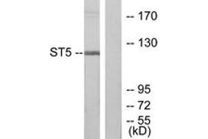 Western blot analysis of extracts from COLO205 cells, using ST5 Antibody. (ST5 antibody  (AA 411-460))