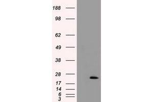 HEK293T cells were transfected with the pCMV6-ENTRY control (Left lane) or pCMV6-ENTRY TNNI3 (Right lane) cDNA for 48 hrs and lysed. (TNNI3 antibody)