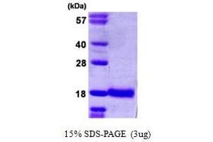 SDS-PAGE (SDS) image for Ubiquitin-Conjugating Enzyme E2D 1 (UBE2D1) (AA 1-147) protein (His tag) (ABIN667460)