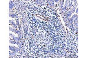 IHC analysis of CD93 using anti-CD93 antibody (ABIN7602865). (CD93 antibody  (C-Term))