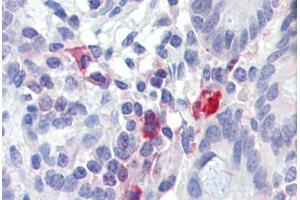 Small intestine, Human: Formalin-Fixed, Paraffin-Embedded (FFPE) (TNFAIP3 antibody)