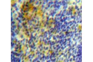 Used in DAB staining on fromalin fixed paraffin-embedded Spleen tissue (PLA2G7 antibody  (AA 22-444))