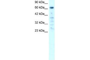 PARP3 antibody used at 1-2 ug/ml to detect target protein. (PARP3 antibody)