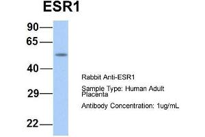 Host:  Rabbit  Target Name:  ESR1  Sample Type:  Human Adult Placenta  Antibody Dilution:  1. (Estrogen Receptor alpha antibody  (Middle Region))