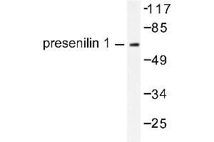 Image no. 1 for anti-Presenilin 1 (PSEN1) antibody (ABIN271789) (Presenilin 1 antibody)