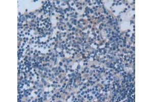 #VALUE! (Signaling Lymphocytic Activation Molecule Family, Member 2 (AA 23-217) antibody)