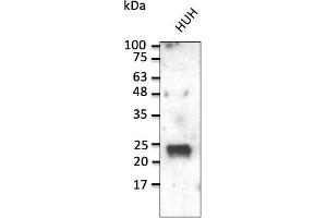 RAB1A Antikörper  (C-Term)
