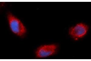 Immunofluorescence (IF) image for anti-Aldehyde Dehydrogenase 1 Family, Member A1 (ALDH1A1) (AA 1-501) antibody (PE) (ABIN5568630) (ALDH1A1 antibody  (AA 1-501) (PE))