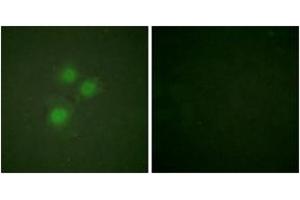 Immunofluorescence (IF) image for anti-MKI67 FHA Domain-Interacting Nucleolar Phosphoprotein (MKI67IP) (AA 200-249) antibody (ABIN2888898)