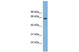 SLFN12 antibody used at 1 ug/ml to detect target protein. (SLFN12 antibody  (Middle Region))