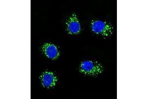 Confocal immunofluorescent analysis of MUSK Antibody (ABIN392021 and ABIN2841797) with MDA-M cell followed by Alexa Fluor 488-conjugated goat anti-rabbit lgG (green). (MUSK antibody)