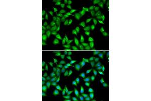 Immunofluorescence analysis of U2OS cells using MYL3 antibody (ABIN6133198, ABIN6144249, ABIN6144250 and ABIN6222363). (MYL3/CMLC1 antibody  (AA 1-195))