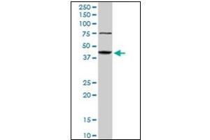 Western Blotting (WB) image for anti-Abhydrolase Domain Containing 5 (ABHD5) antibody (ABIN781986) (ABHD5 antibody)