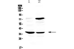 Western Blotting (WB) image for anti-Fc Fragment of IgE, Low Affinity II, Receptor For (CD23) (FCER2) (AA 48-284) antibody (ABIN5693198)