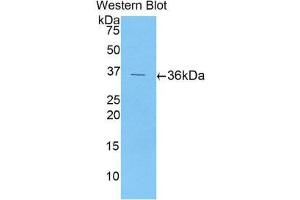 Western Blotting (WB) image for anti-Chemokine (C-X-C Motif) Ligand 5 (CXCL5) (AA 38-114) antibody (ABIN1077995)