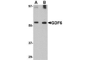 Western blot analysis of GDF6 in SK-N-SH lysate with AP30360PU-N GDF6 antibody at (A) 0. (GDF6 antibody  (C-Term))