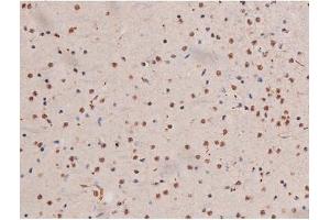 ABIN6267503 at 1/200 staining Mouse brain tissue sections by IHC-P.