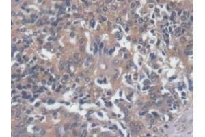 Immunohistochemistry (IHC) image for anti-Pro-Brain Natriuretic Peptide (NT-ProBNP) (NT-ProBNP) (AA 27-102) antibody (ABIN7439867)