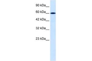 Western Blotting (WB) image for anti-Dachshund 2 (DACH2) antibody (ABIN2460463)