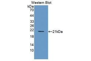 Detection of Recombinant PDGFBB, Human using Monoclonal Antibody to Platelet Derived Growth Factor BB (PDGF BB) (PDGF-BB Homodimer (AA 82-190) antibody)