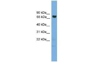 WB Suggested Anti-GCLC Antibody Titration: 0. (GCLC antibody  (Middle Region))
