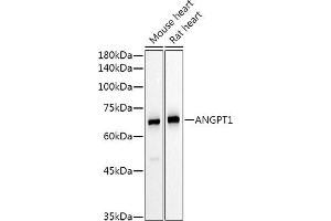 Western blot analysis of extracts of various cell lines, using  Rabbit pAb antibody (ABIN6127432, ABIN6136873, ABIN6136875 and ABIN6223859) at 1:500 dilution. (Angiopoietin 1 antibody  (AA 260-400))