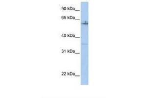 Image no. 1 for anti-Proximal Sequence Element 1 (SPDEF) (AA 74-123) antibody (ABIN6737682) (SPDEF/PSE antibody  (AA 74-123))