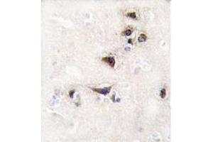 Formalin-fixed and paraffin-embedded human brain tissue reacted with CAMK2 alpha Antibody (C-term) , which was peroxidase-conjugated to the secondary antibody, followed by DAB staining. (CAMK2A antibody  (C-Term))