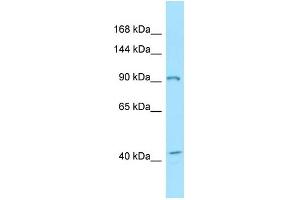 WB Suggested Anti-EPHB3 Antibody Titration: 1. (EPH Receptor B3 antibody  (C-Term))