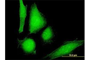 Immunofluorescence of purified MaxPab antibody to COP1 on HeLa cell. (CARD16 antibody  (AA 1-97))