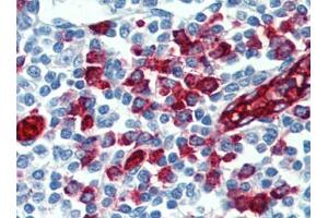 Immunohistochemistry (IHC) image for anti-Selectin P Ligand (SELPLG) antibody (ABIN614543) (SELPLG antibody)