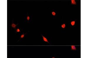 Immunofluorescence analysis of PC12 cells using PRDM14 Polyclonal Antibody at dilution of 1:100. (PRDM14 antibody)