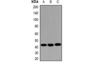 Western blot analysis of HSD17B2 expression in SW480 (A), mouse liver (B), mouse kidney (C) whole cell lysates. (HSD17B2 antibody)
