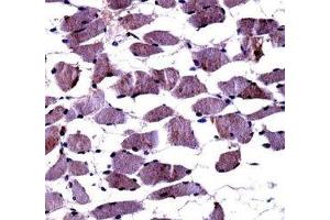 TrkA antibody immunohistochemistry analysis in formalin fixed and paraffin embedded human skeletal muscle. (TRKA antibody  (AA 769-796))