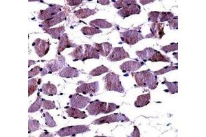 TrkA antibody immunohistochemistry analysis in formalin fixed and paraffin embedded human skeletal muscle.