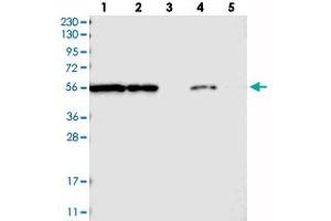 Western blot analysis of Lane 1: RT-4, Lane 2: U-251 MG, Lane 3: Human Plasma, Lane 4: Liver, Lane 5: Tonsil with FKBP9 polyclonal antibody  at 1:250-1:500 dilution. (FKBP9 antibody)