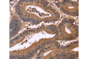 Immunohistochemistry (IHC) image for anti-Cell Division Cycle 37-Like 1 (CDC37L1) antibody (ABIN2429747) (CDC37L1 antibody)